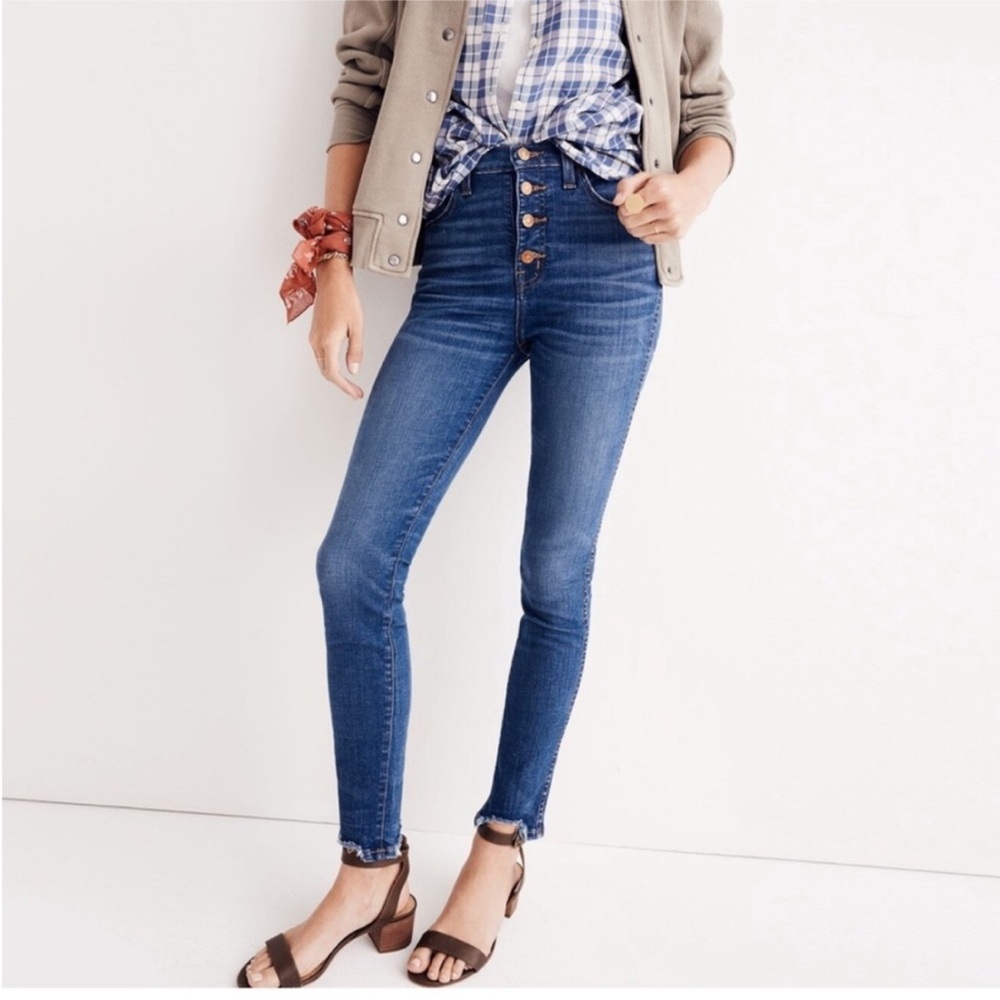 Madewell Button Fly High-Waisted Jeans